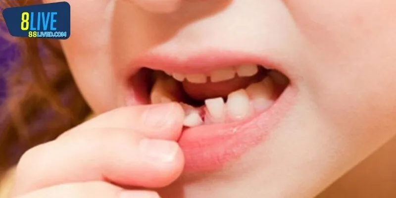 Mơ thấy rụng răng mang ý nghĩa như thế nào?